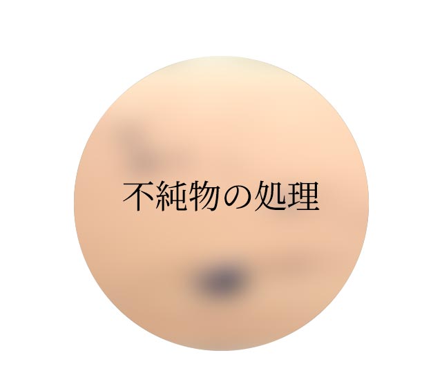 不純物の処理